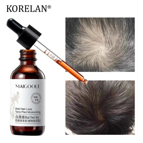 헤어토닉 탈모 방지 성장촉진 개선 원형탈모/정수리탈모/M자탈모 두피에센스 구매 전 필수 체크 포인트 post thumbnail image